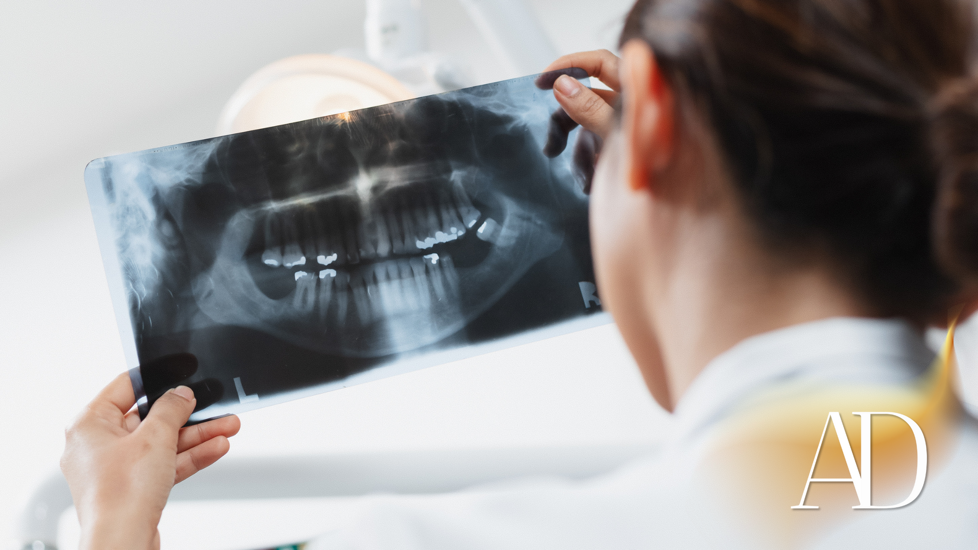 A dentist is looking at an x-ray of a patient 's teeth.