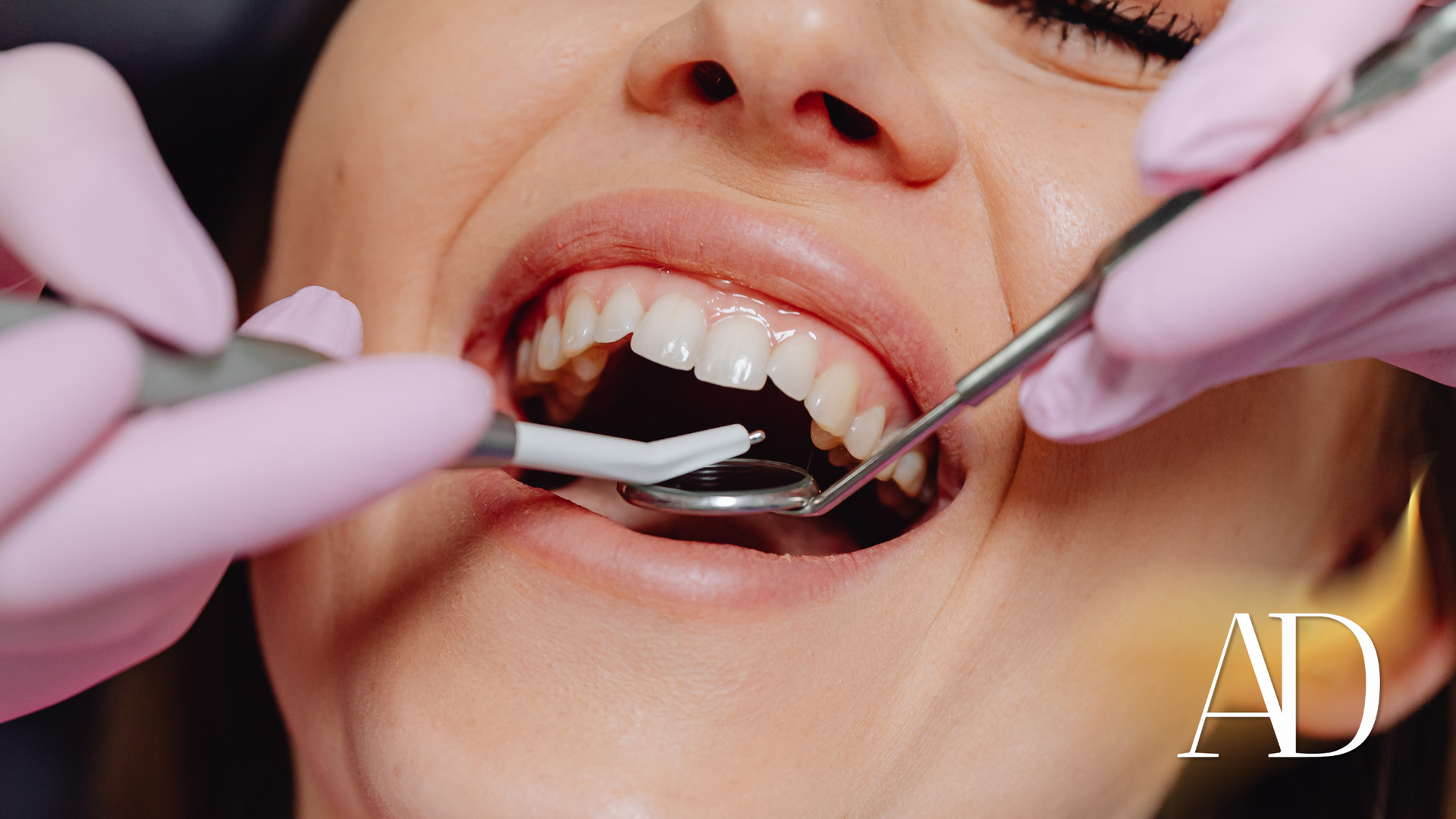 A woman is getting her teeth examined by a dentist.