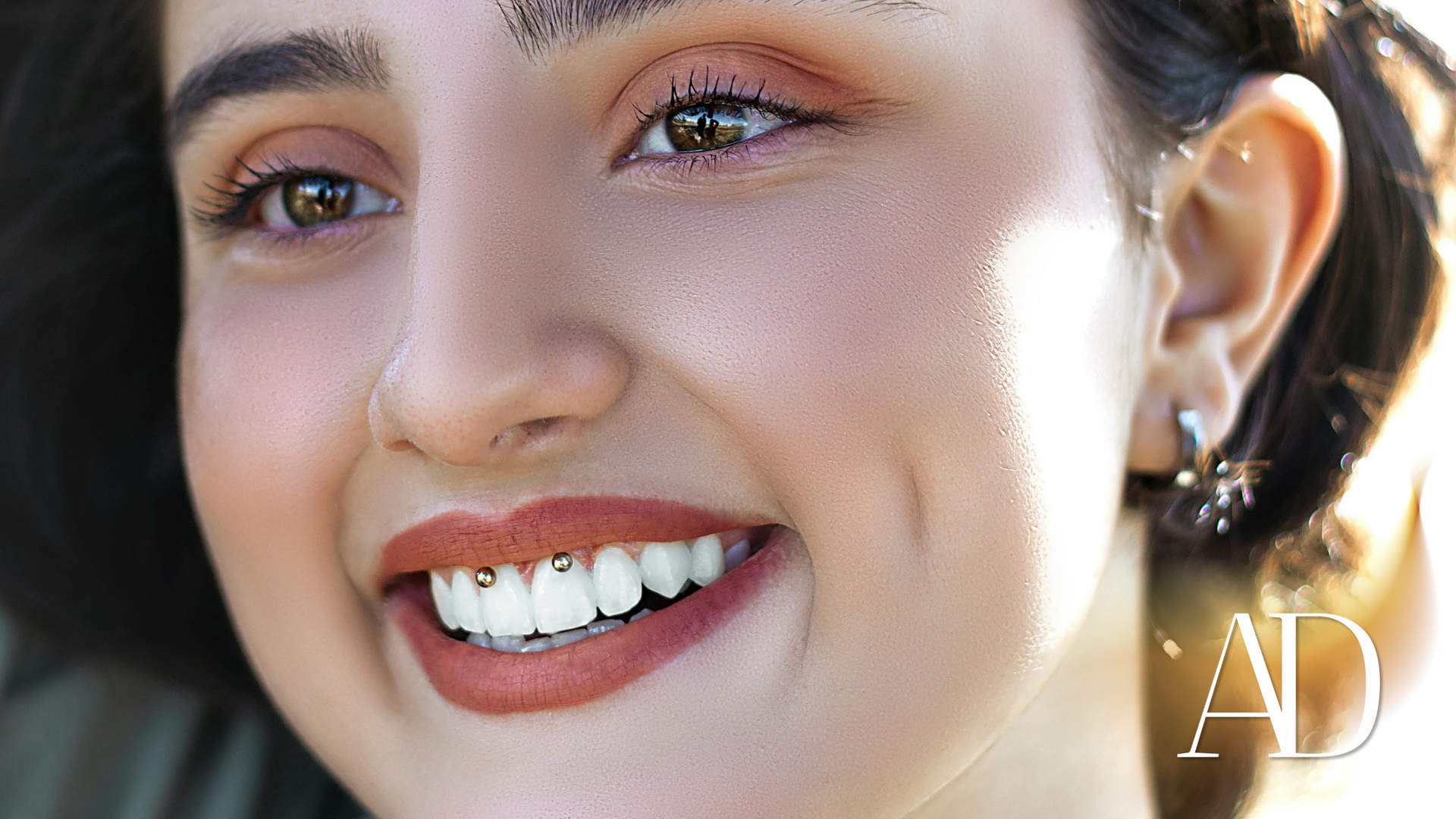 A close up of a woman 's face with braces on her teeth.
