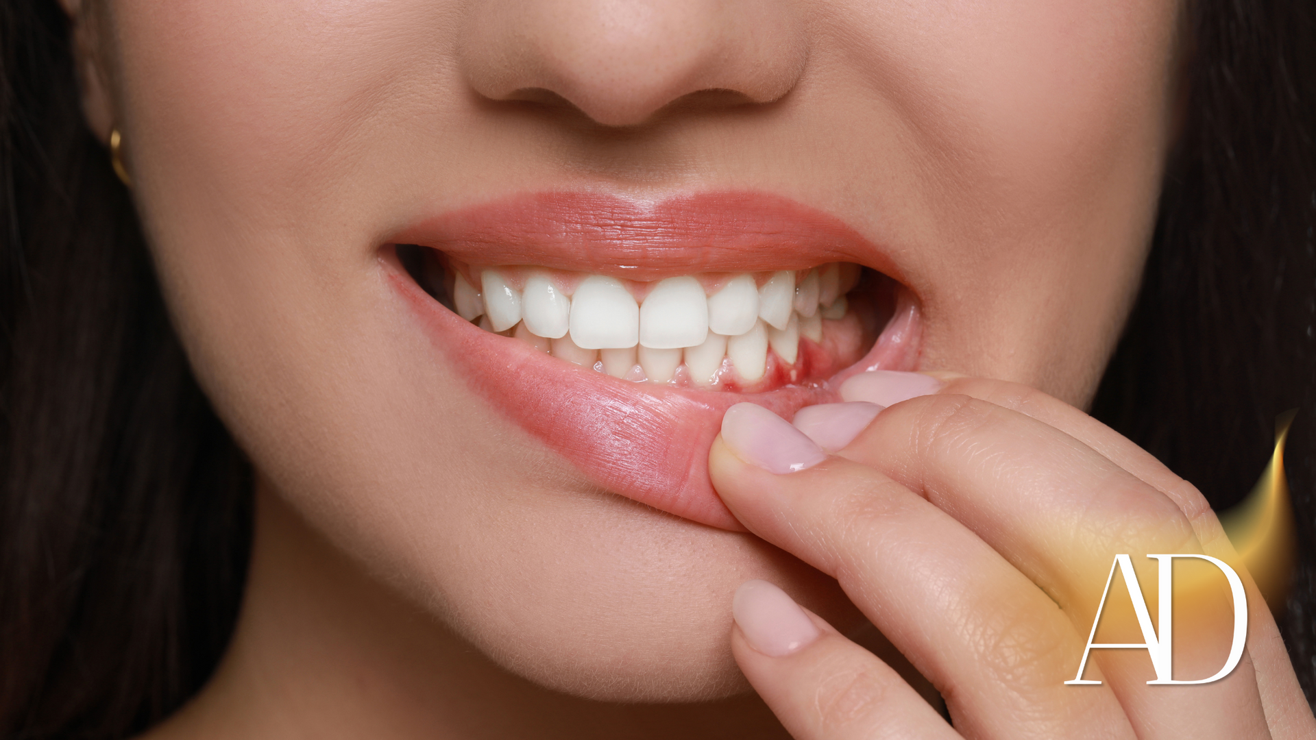 A close up of a woman 's mouth with her hand on her teeth.