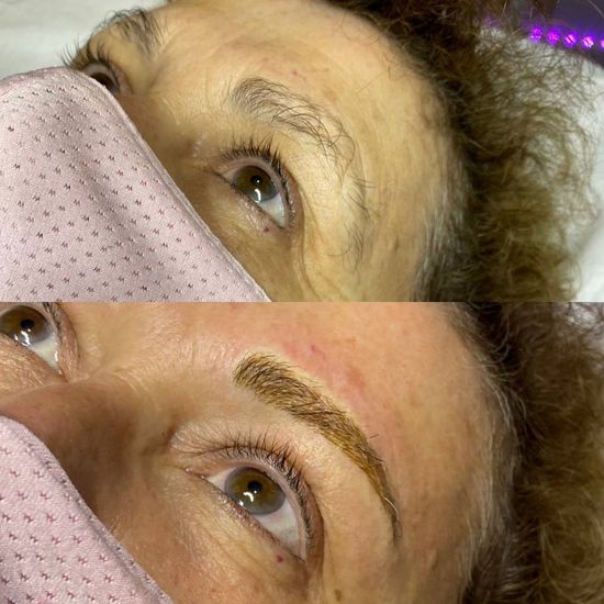 before and after microblading results