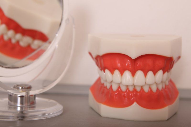 modello di una dentatura