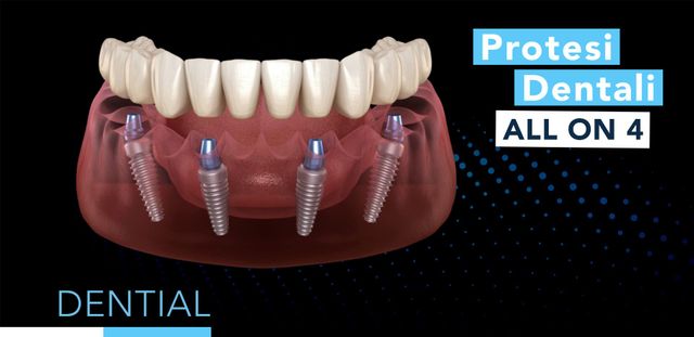 Promozioni cure dentali Durazzo