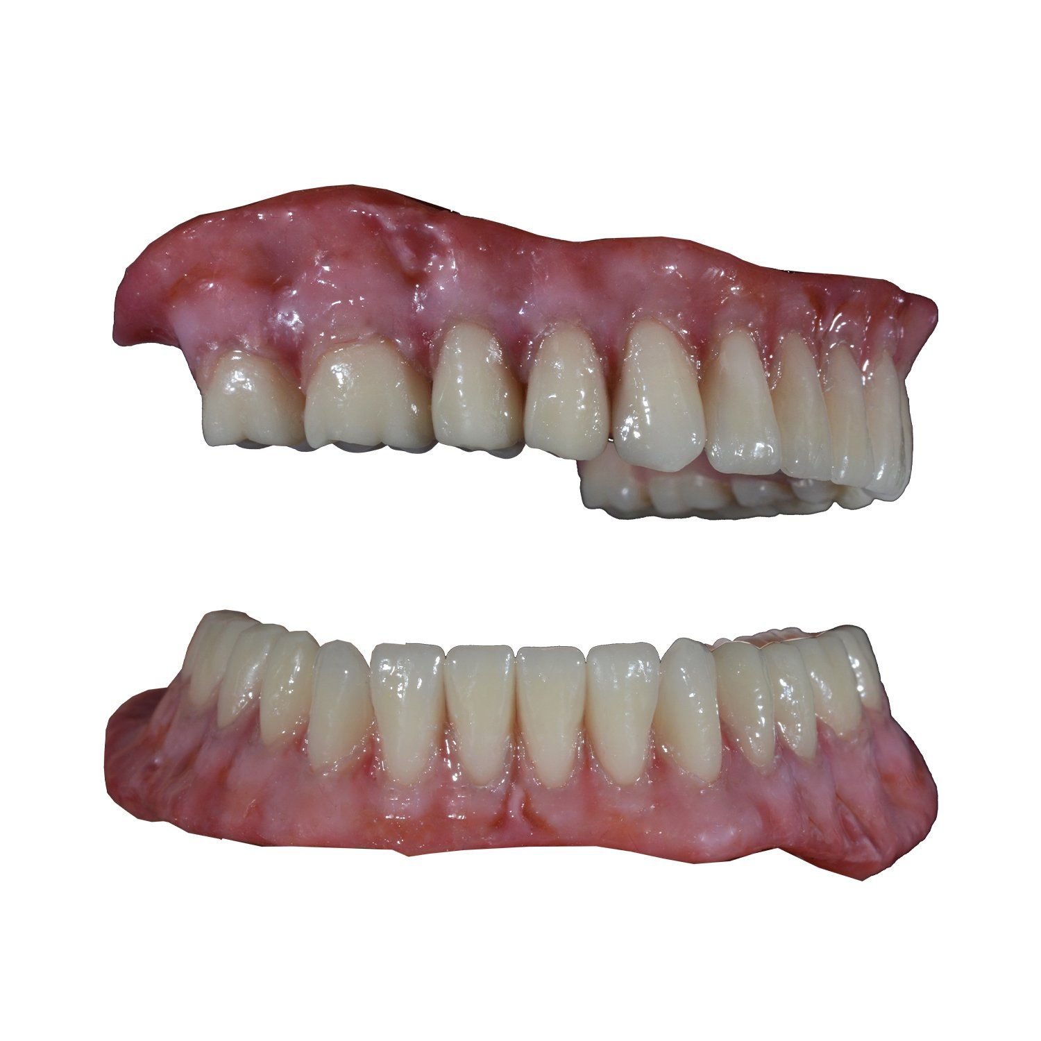 protesi dentali in Albania