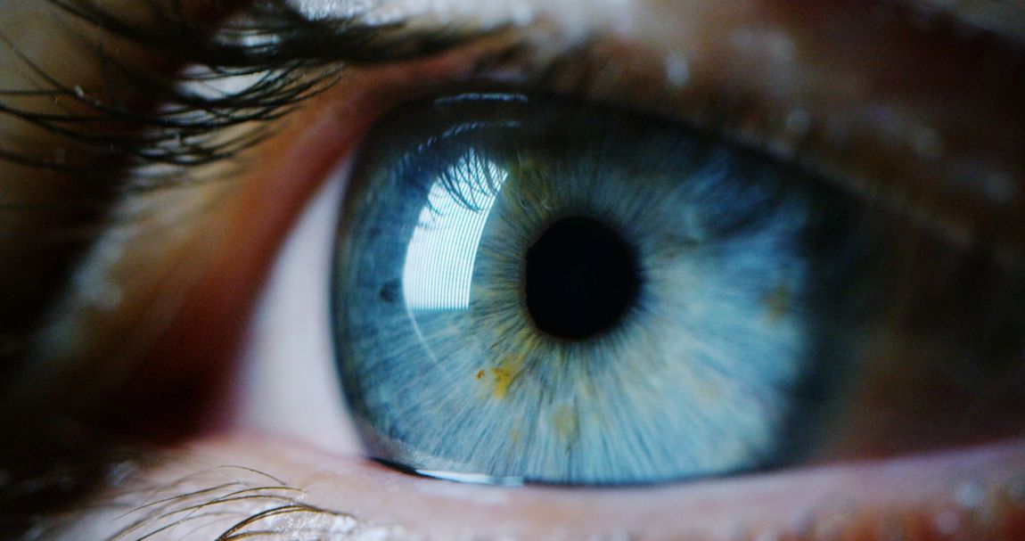 occhio con distacco della retina