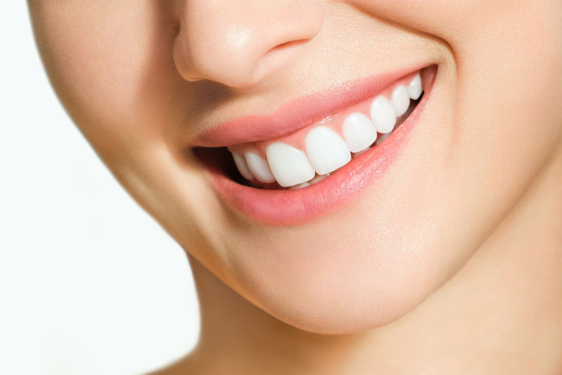 A Close-up Of a Woman's Smile with White Teeth — Cane to Coast Dentures in Sarina, QLD