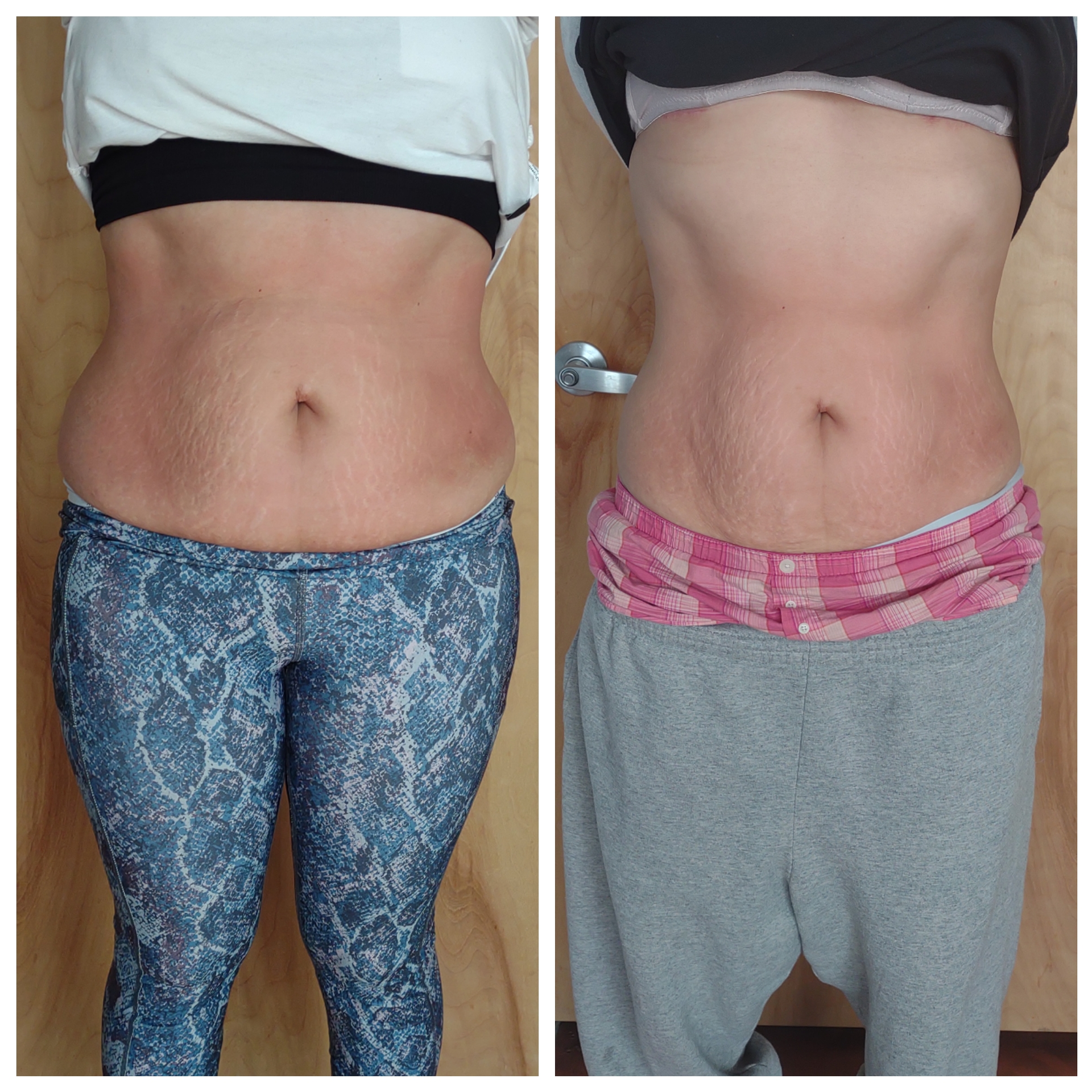 Side-by-side torso comparison showing a woman’s midsection in different pants and tops.