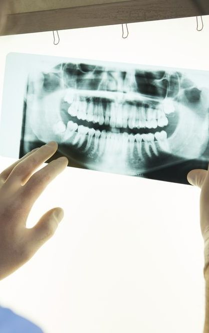 A Person is Looking at an X-ray of a Person's Teeth — Graham Johnson Dental Surgery In Beresfield, NSW