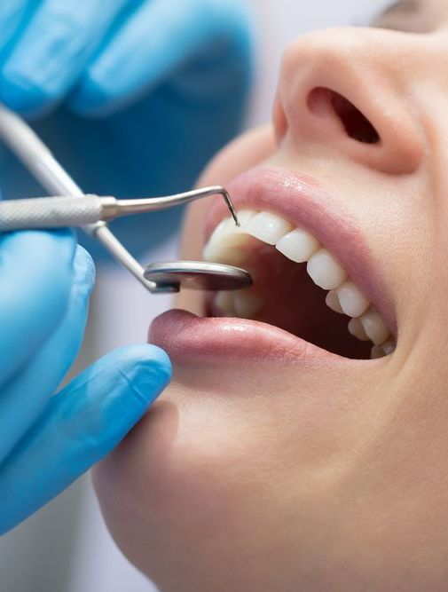 A Woman is Getting Her Teeth Examined by a Dentist — Graham Johnson Dental Surgery In Beresfield, NSW