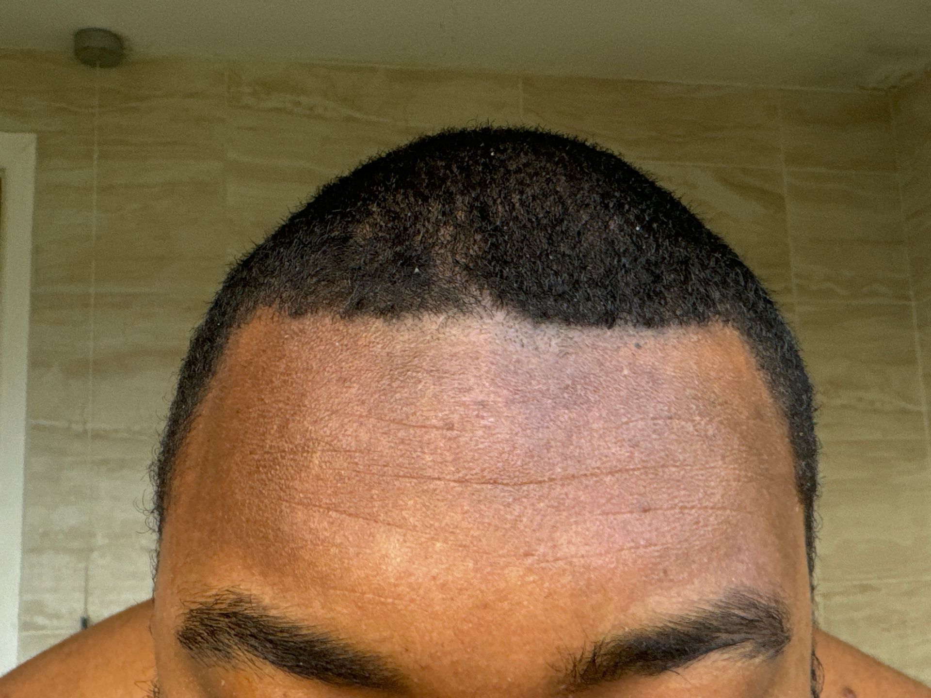 Hydrated skin on forehead