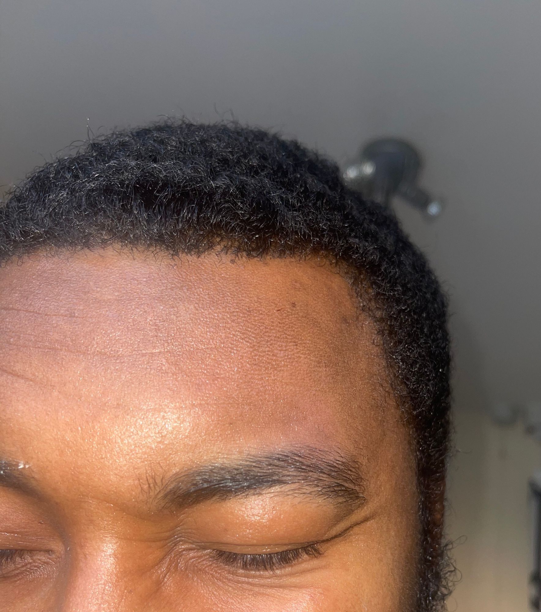 Hydrated skin on forehead