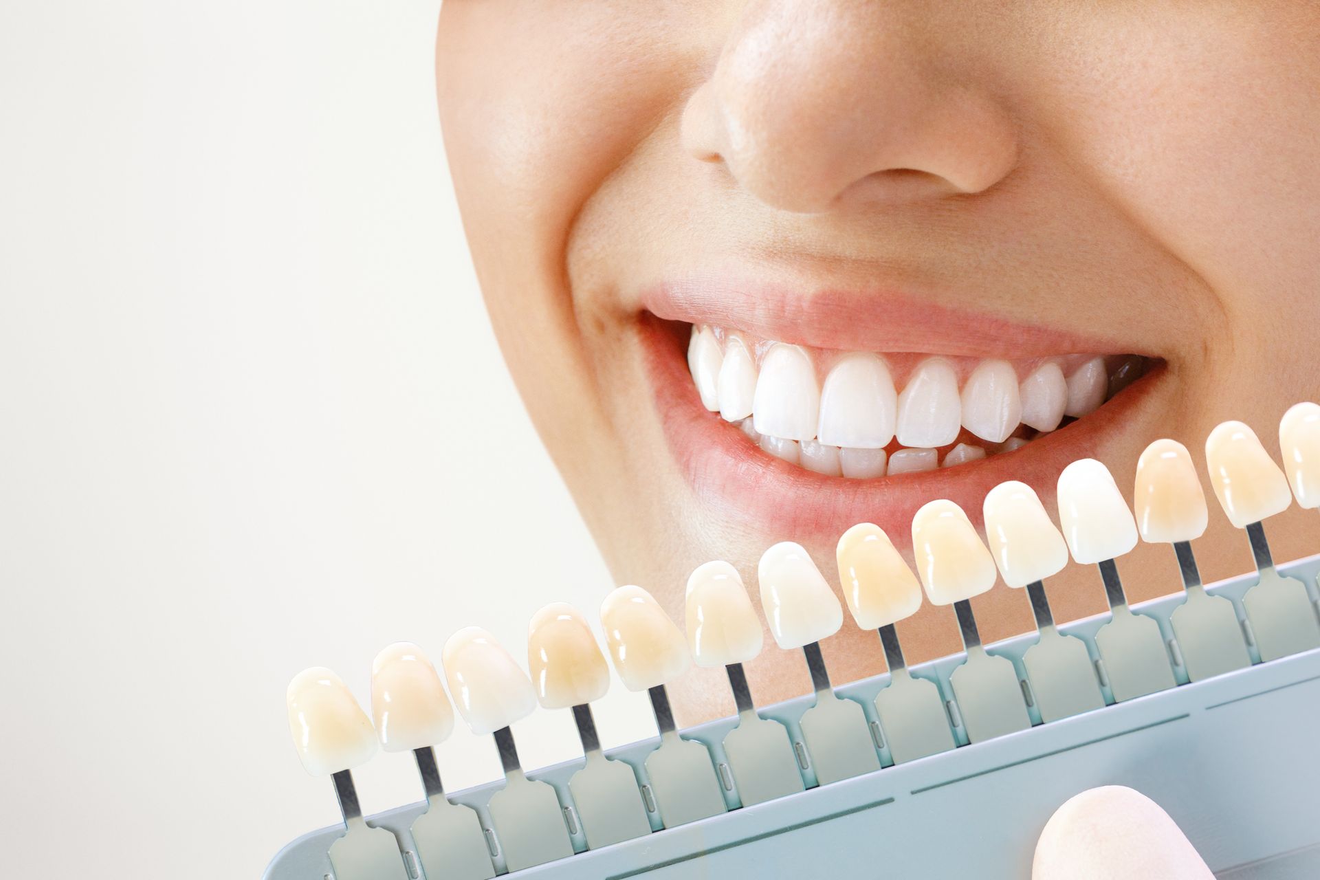 Shade guide held near a set of teeth to compare color for a whitening treatment.