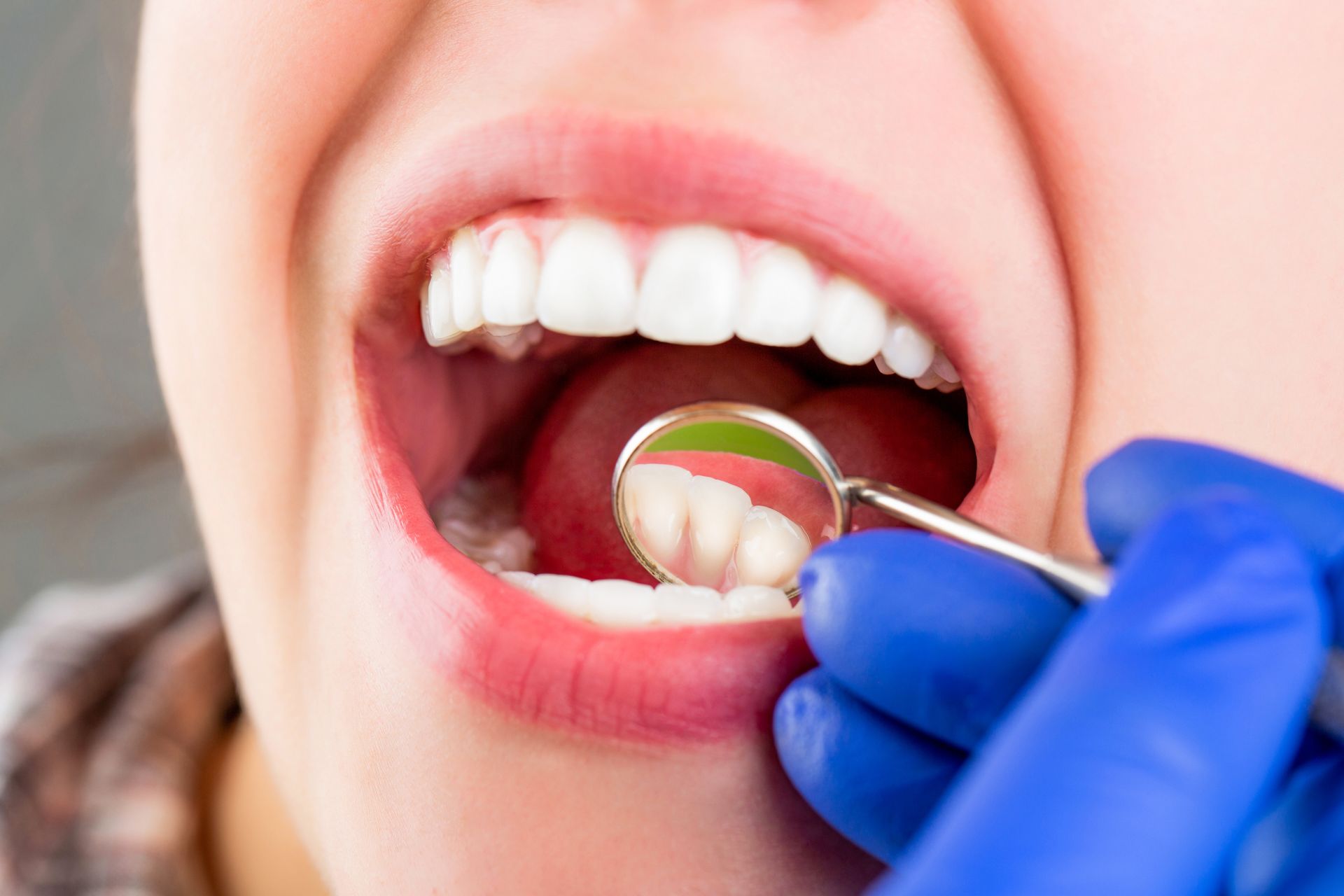 A close-up of a general dentist performing an examination on a patient's teeth.