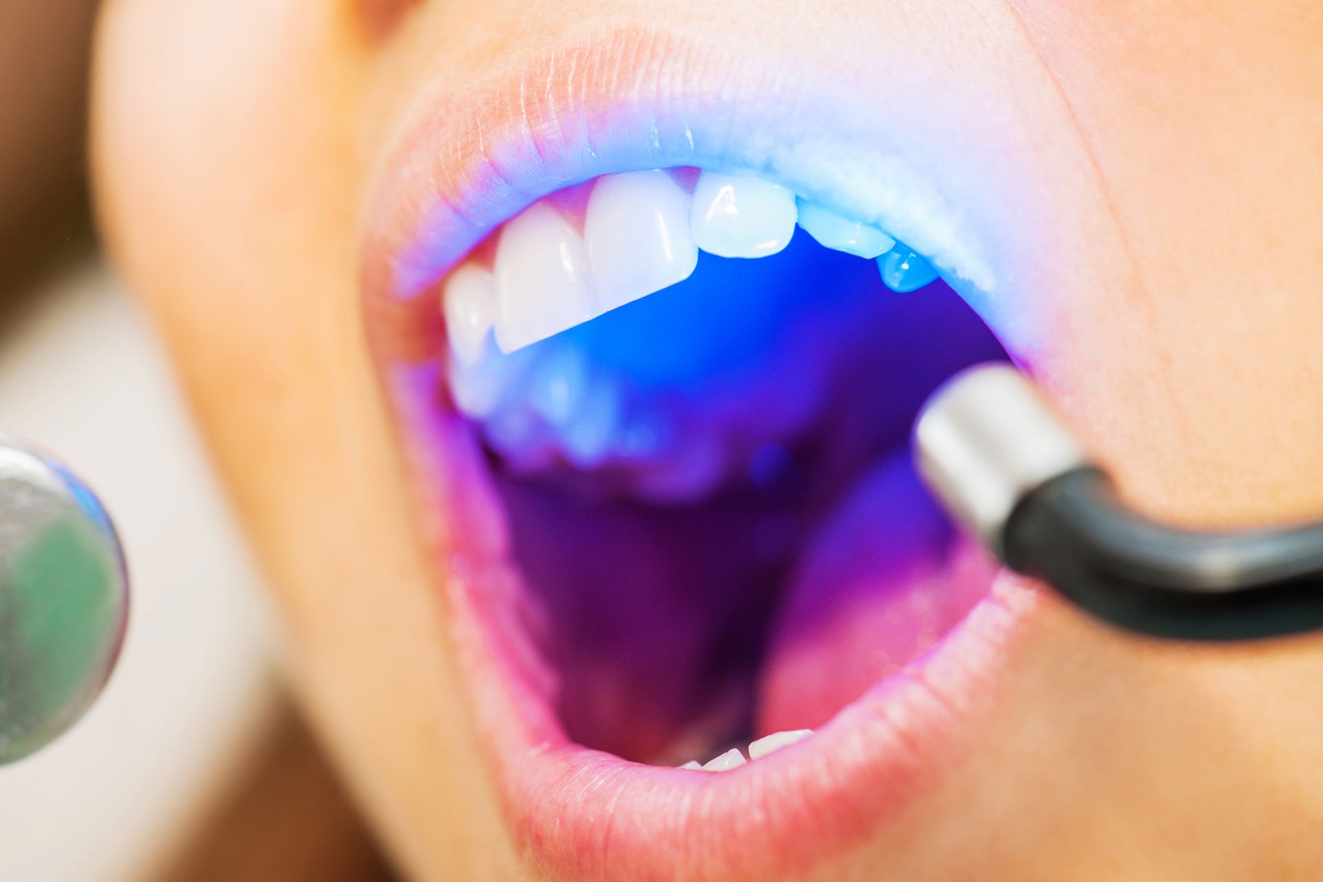 A woman is getting her teeth whitened with a light.