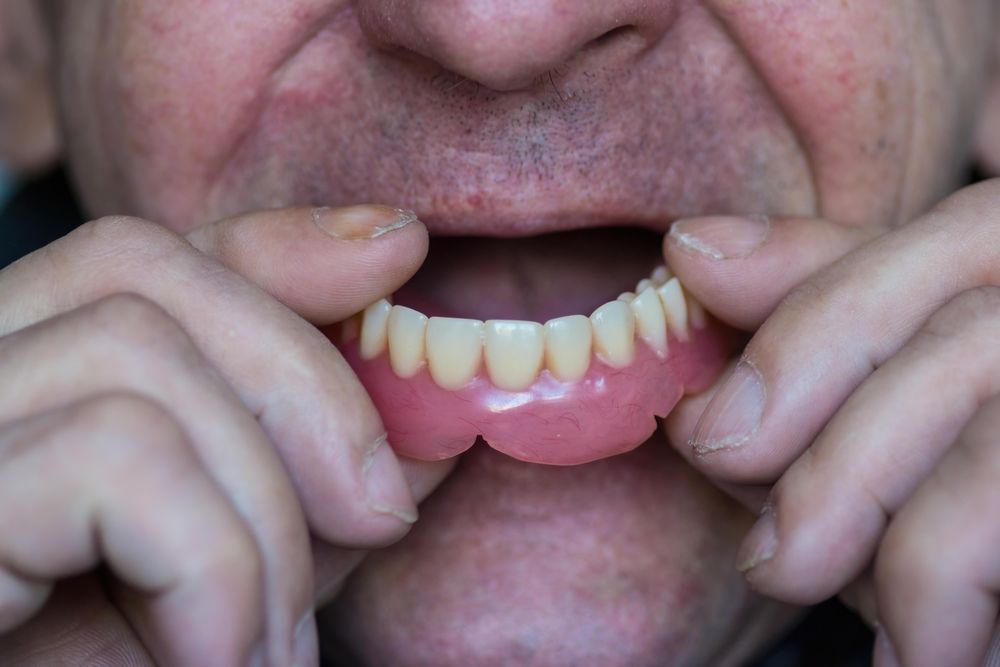 A Man is Holding His Dentures in His Mouth — Dental Prosthetics By Richard & Cindy In Oxenford, QLD