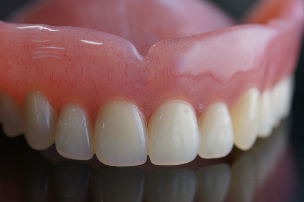 Upper Teeth Denture with Pink Gums