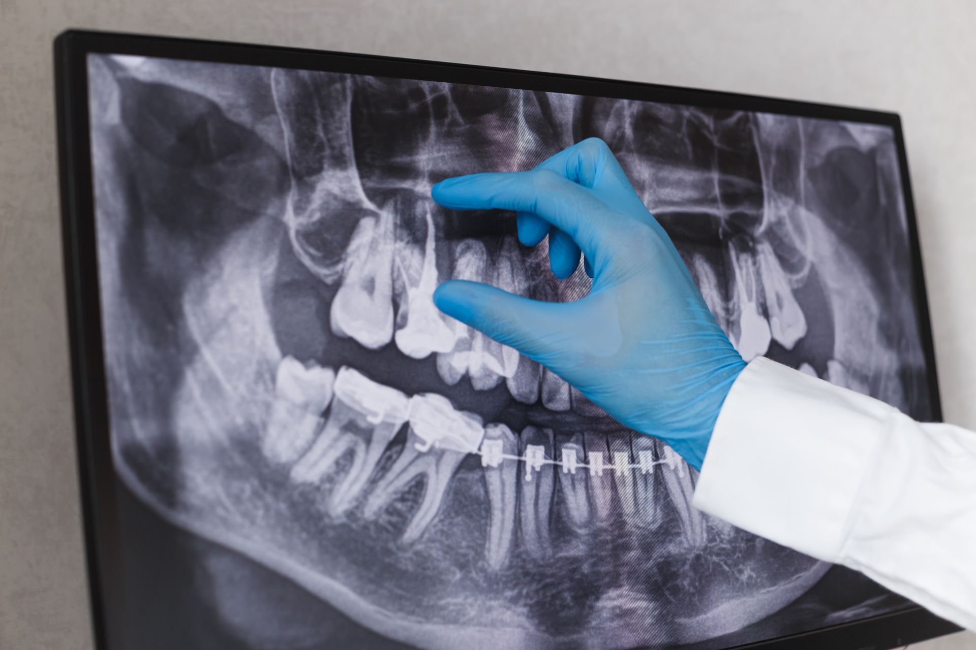 A dentist is looking at an x-ray of a person 's teeth.