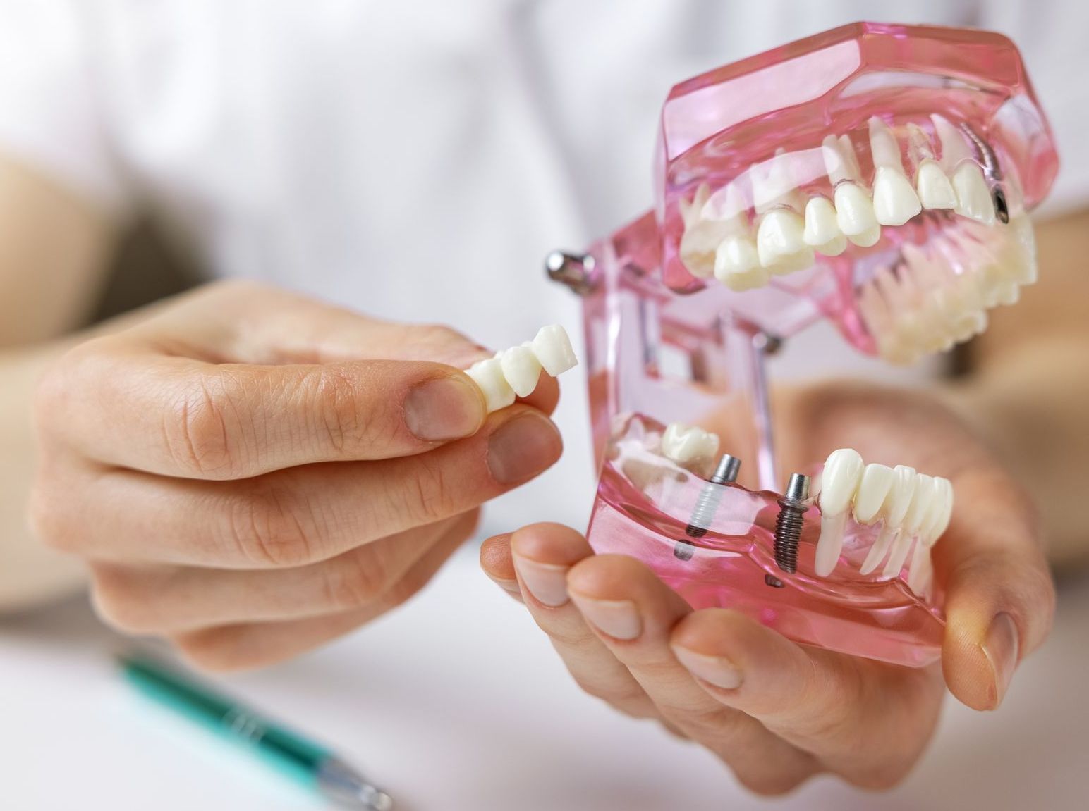 A person is holding a model of a dental implant in their hands.