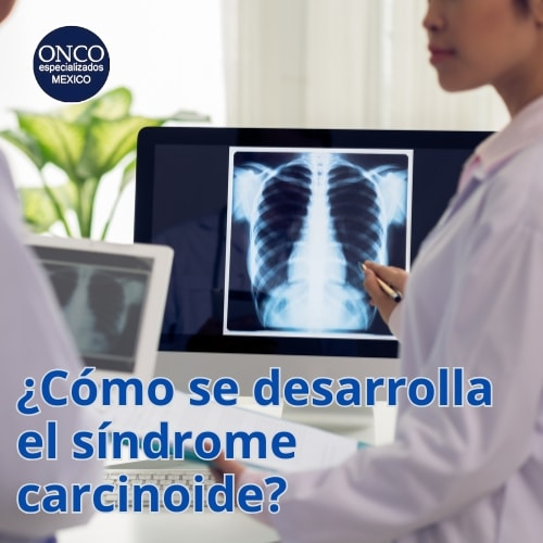Médico analizando cómo se desarrolla el síndrome carcinoide