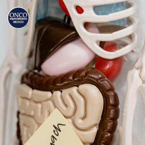 Modelo anatómico mostrando órganos abdominales afectados.