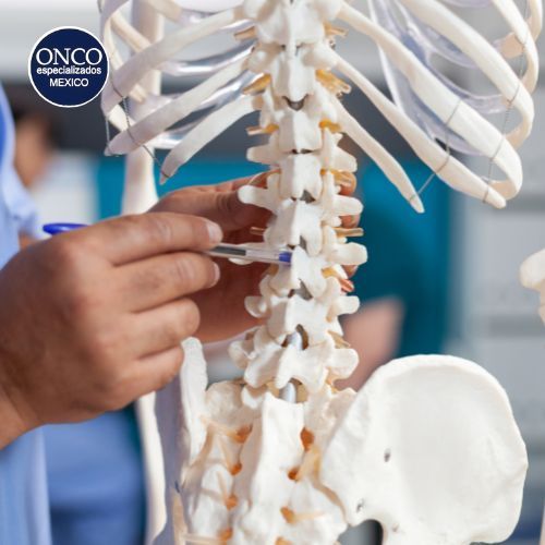 Modelo anatómico con espondilitis.