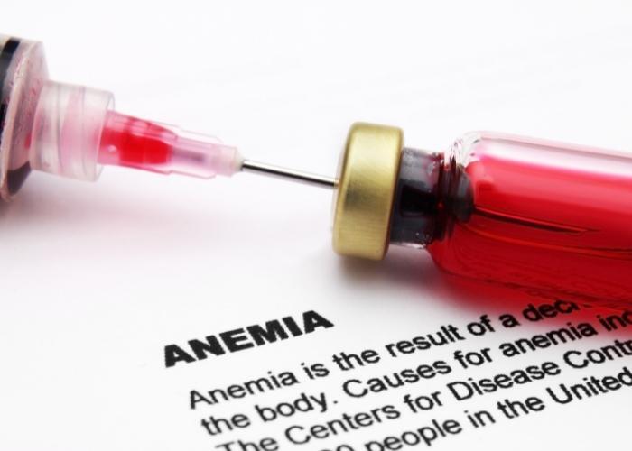 leuprorelina y anemia