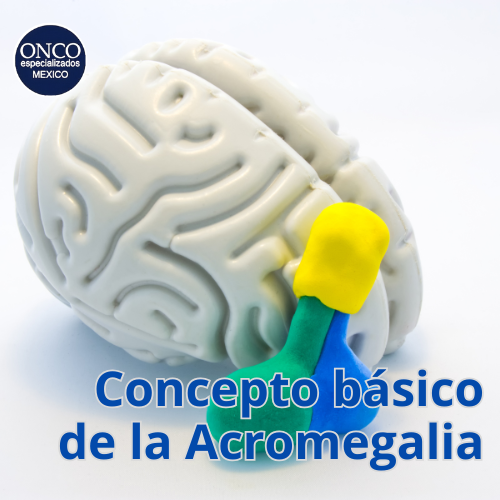 Una imagen de un cerebro con las palabras concepto básico de la acromegalia debajo.