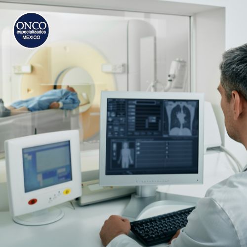 Tomografía para diagnóstico de mesotelioma.