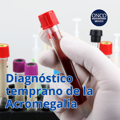 Prueba de sangre para diagnóstico temprano de la acromegalia.