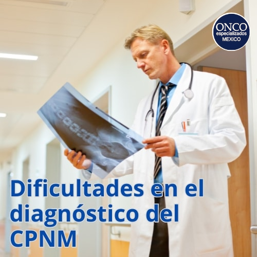 Médico revisando imágenes para diagnóstico de carcinoma pulmonar.