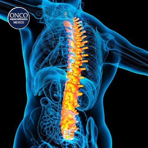 Una imagen generada por computadora de la columna vertebral de una persona con la palabra 