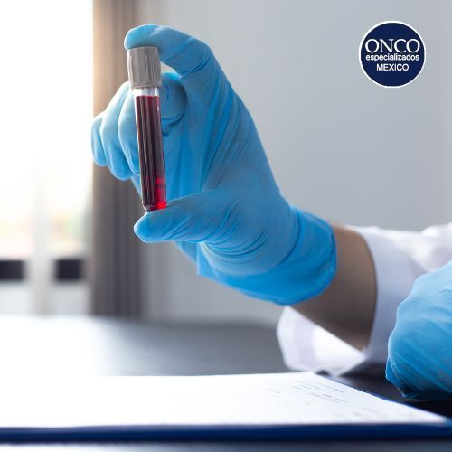 Hemoglobinuria Paroxística Nocturna