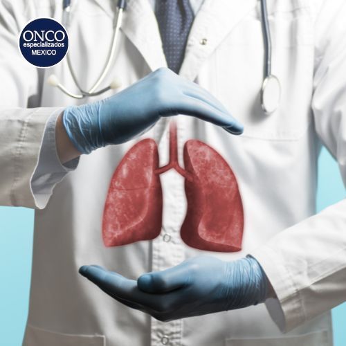 Un médico sostiene una imagen de pulmones en sus manos.