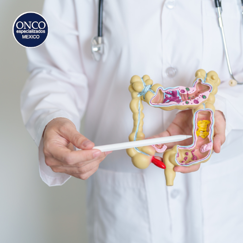 Un médico sostiene un modelo de intestino grueso.