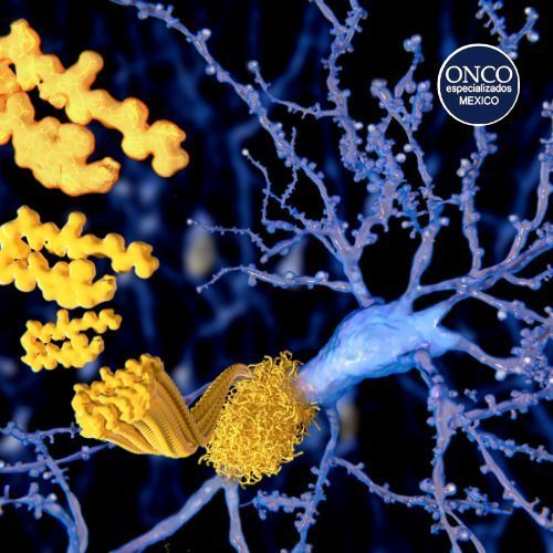 Fibras amiloides vistas a través de un microscopio.
