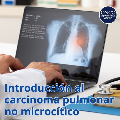 Cáncer de Pulmón No Microcítico