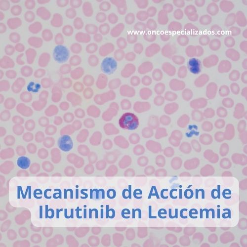 El Ibrutinib actúa en las células cancerosas en el tratamiento de la leucemia linfocítica crónica.