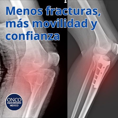 Radiografías de rodilla que muestran mejora en estructura ósea.