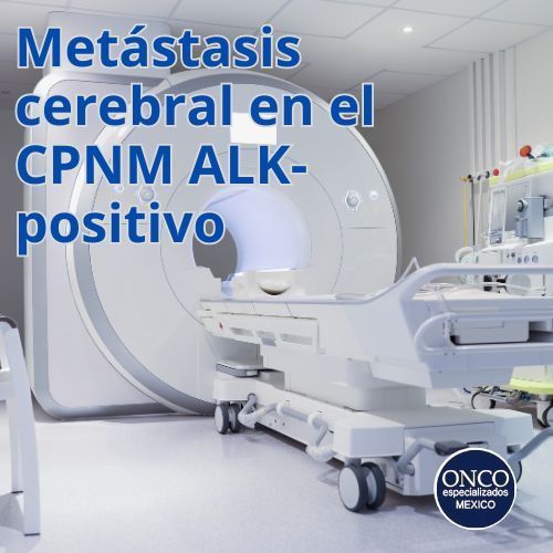 Tomografía de metástasis cerebral en CPNM ALK-positivo.