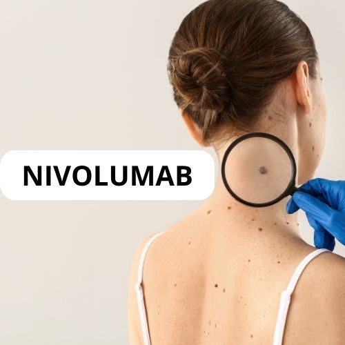 Un médico examina melanoma tratamiento nivolumab