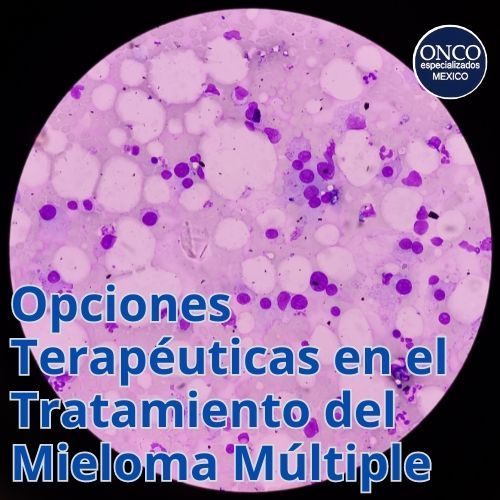 mieloma múltiple, ilustrando las diversas opciones de tratamiento disponibles para esta enfermedad.