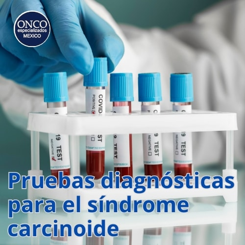 Tubos de ensayo para pruebas diagnósticas del síndrome carcinoide