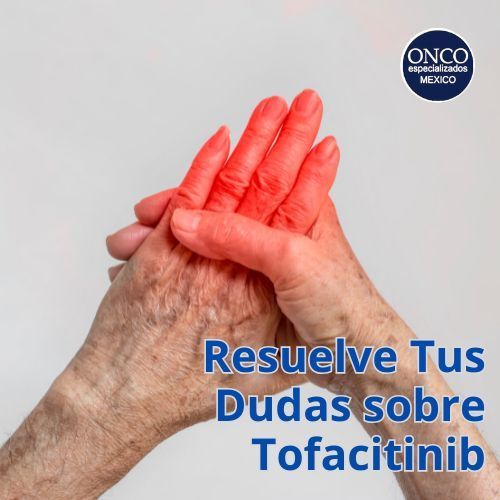 Manos con inflamación articular asociadas al uso de tofacitinib.