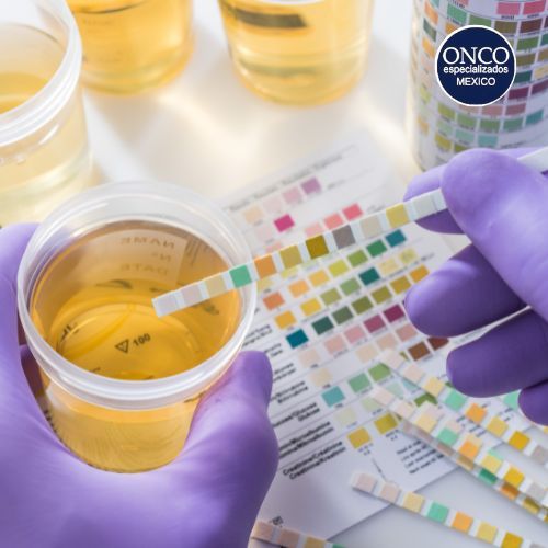 Análisis de orina para detectar hemólisis y otros síntomas.