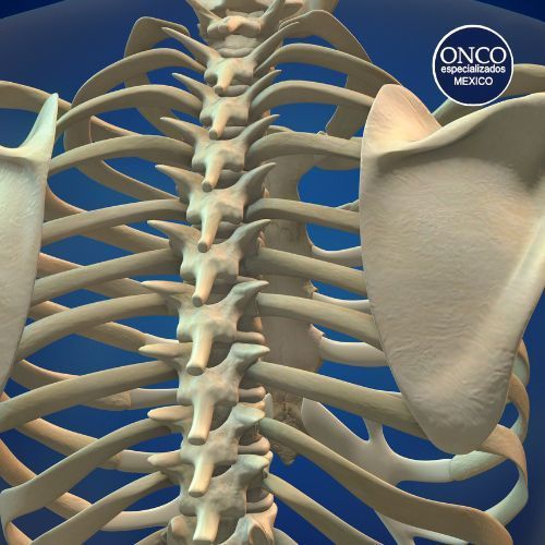 Modelo de columna mostrando síntomas de osteoporosis.
