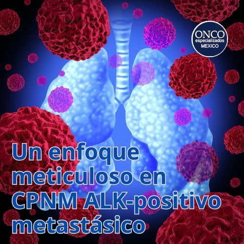Células metastásicas de CPNM ALK-positivo.
