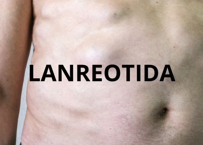 El torso de un hombre con la palabra lanreotida escrita.