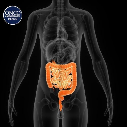 Una radiografía del estómago y el intestino grueso de una persona