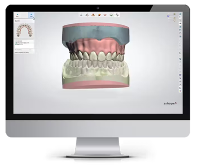 Denture digital model — Kurrajong, NSW — Kurrajong Denture Clinic