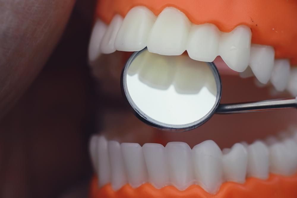 A Close up Of a Person 's Teeth with A Dental Mirror — Cosmetic Denture Services–Jacob Maxwell in Moranbah, QLD